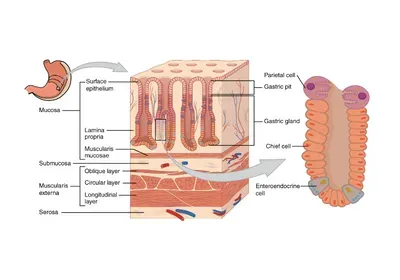 chief cell stomach gastric gland cancer dedifferentiation chief cell stomach gastric gland cancer dedifferentiation